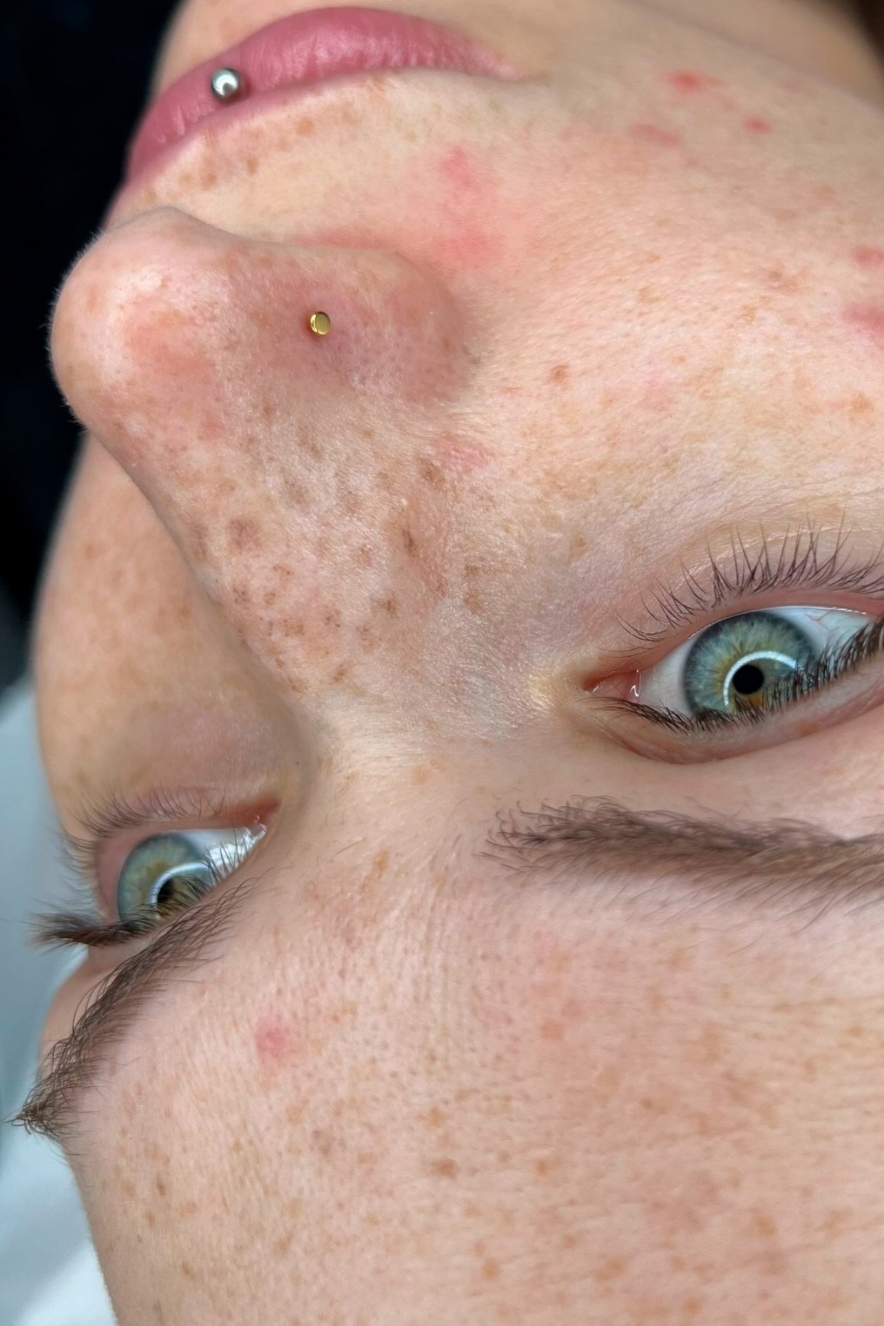 efekt-sunkissed-piegi-na-nosie