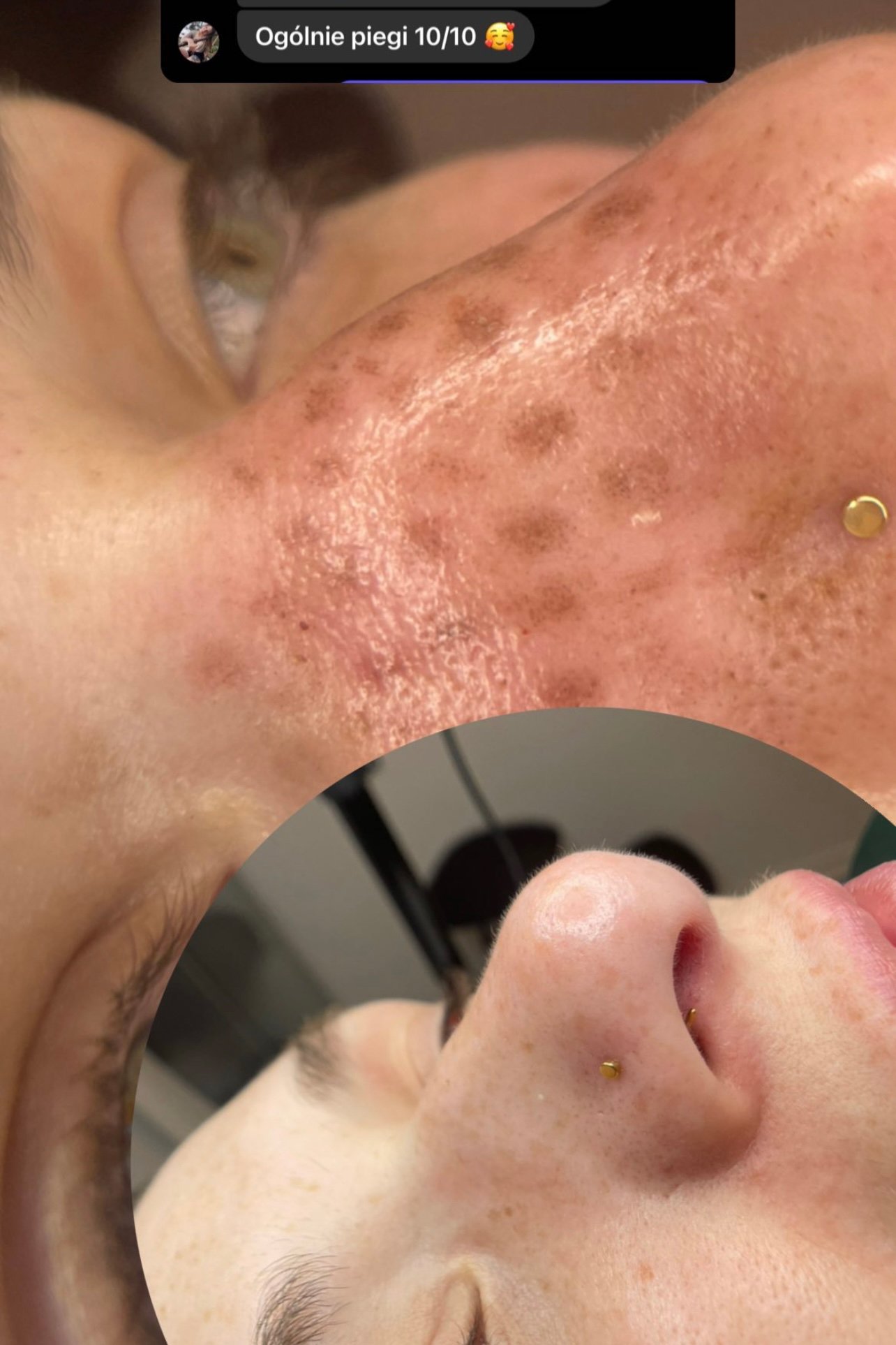 piegi-permanentne-przed-i-po-metamorfoza